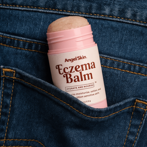 Eczema Body Balm