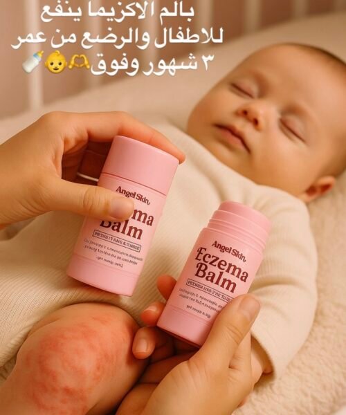 Alternative view of Eczema Body Balm